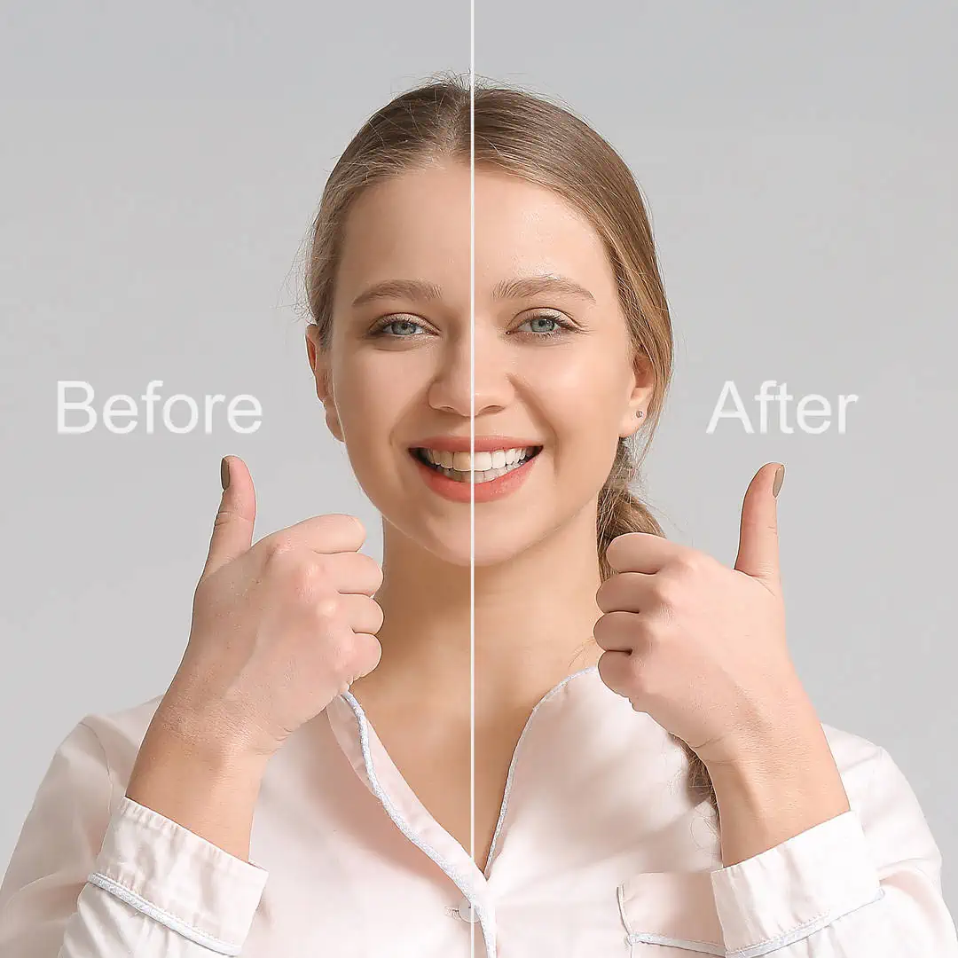 Smile makeover consultation at Glassell Dental in Orange, CA