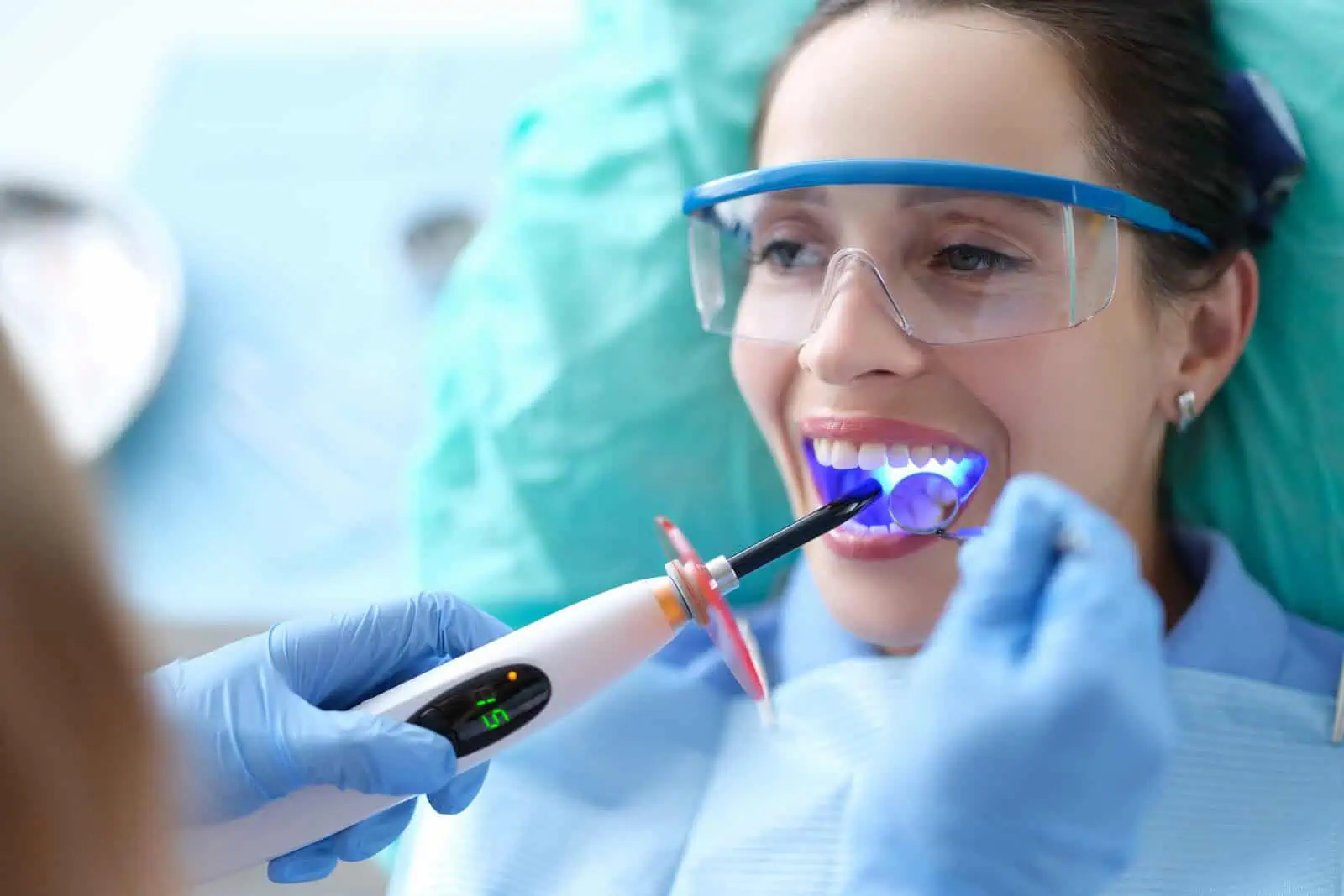 Cosmetic dental bonding at Glassell Dental in Orange, CA